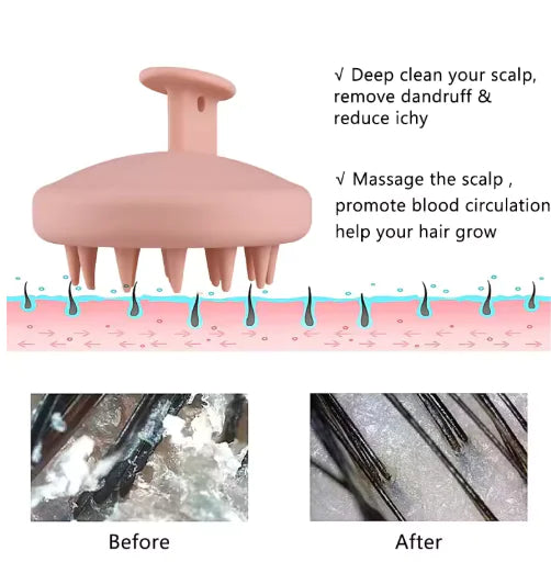 Silicone Shampoo Brush Head & Scalp Cleaning Massager – Soft TPE for Hair & Scalp Health