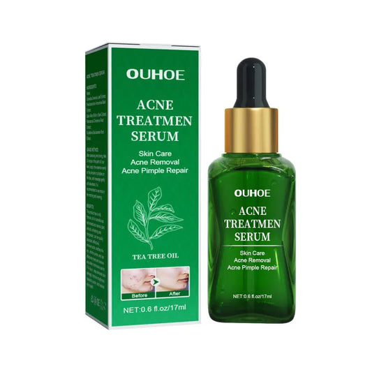 OUHOE Anti-Acne Facial Serum for Oil Control & Pores