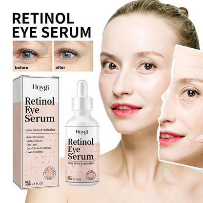 Retinol Eye Serum