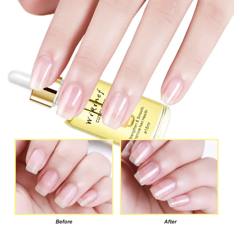 Nail Care Oil with Plant Extracts
