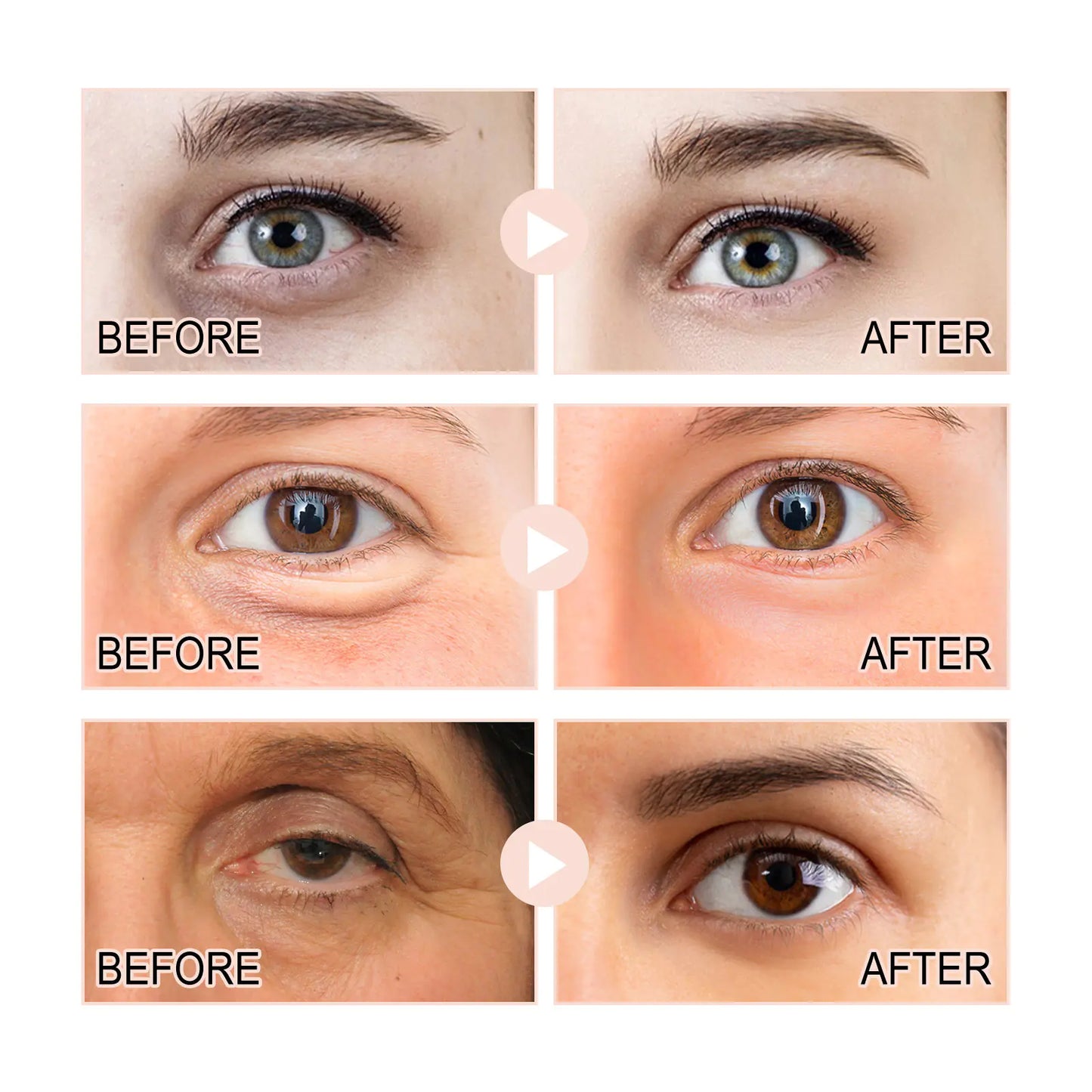 Retinol Eye Serum