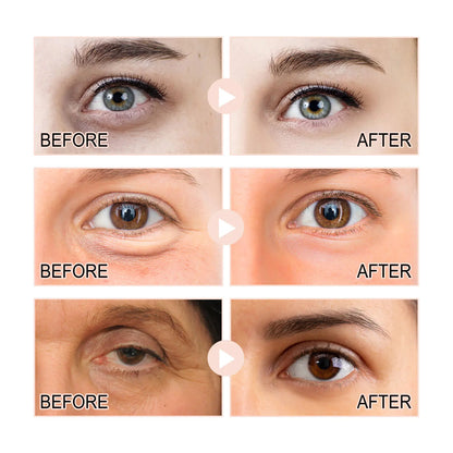 Retinol Eye Serum