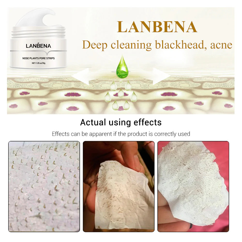 Blackhead Removal Peel-Off Mask
