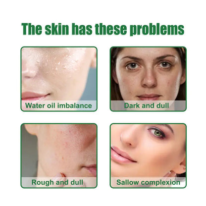 OUHOE Anti-Acne Facial Serum for Oil Control & Pores
